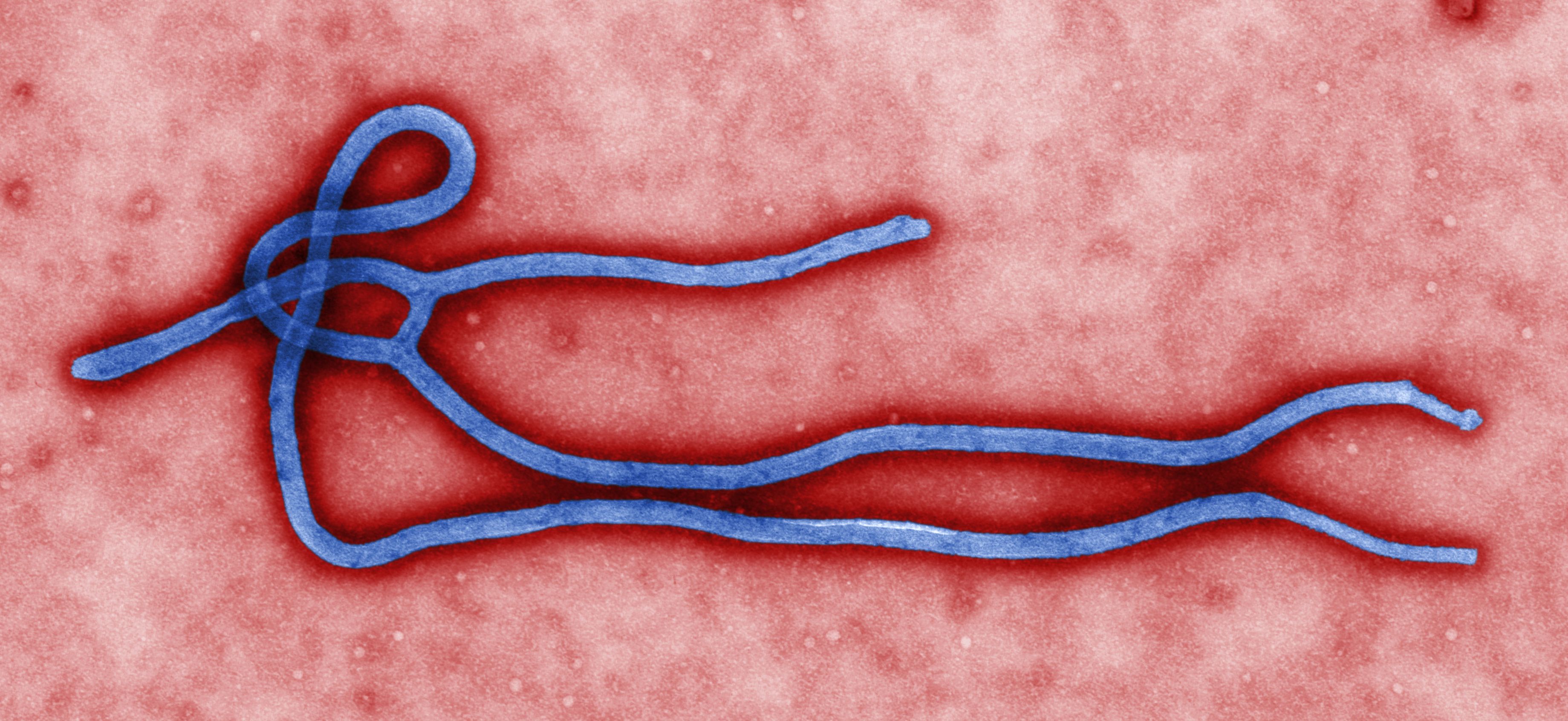 Government ensures a strict surveillance for Ebola virus 